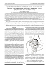 Научная статья на тему 'Декомпрессия головки в профилактике аваскулярного некроза при медиальных переломах бедренной кости (предварительное исследование)'