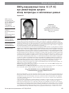 Научная статья на тему 'Ифну-индуцируемый белок 10 (ip-10) при ревматоидном артрите: обзор литературы и собственные данные'