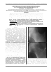 Научная статья на тему 'Отбор признаков для задачи диагностики остеопороза по рентгеновским изображениям шейки бедра'