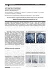 Научная статья на тему 'Первый опыт эндоваскулярной эмболизации и удаления менингиомы крыльев основной кости'