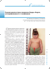Научная статья на тему 'Ранняя диагностика синдрома Барде-Бидля, ассоциированного с ожирением'