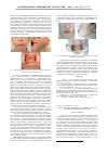 Научная статья на тему 'Распространенность речевых нарушений у детей с деформацией зубочелюстной системы'