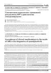 Научная статья на тему 'Соответствие клинических проявлений результатам МРТ в диагностике спондилоартрита'