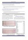 Научная статья на тему 'A case of cardiac arrest following electrocution: a case report'