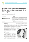 Научная статья на тему 'A giant bulla case that developed in the late period after Covid 19: a case report'