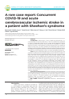 Научная статья на тему 'A rare case report: Concurrent COVID-19 and acute cerebrovascular ischemic stroke in a patient with Sheehan’s syndrome'