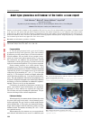 Научная статья на тему 'Adult type granulosa cell tumour of the testis: a case report'
