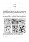 Научная статья на тему 'Advances in wideband (0.3-30 MHz) laser optoacoustic diagnostics'