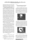 Научная статья на тему 'Акустическая неоднородность эхографического изображения полости желчного пузыря при заболеваниях желчевыводящей системы у детей'