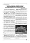 Научная статья на тему 'Анализ представлений о зубных отложениях'