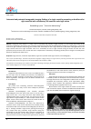Научная статья на тему 'Antenatal and postnatal sonographic imaging findings of a single ventricle presenting as double outlet right ventricle with rudimentary left ventricle and single atrium'