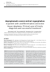 Научная статья на тему 'Asymptomatic severe mitral regurgitation in patient with undifferentiated connective tissue dysplasia. Clinical case of timely diagnosis and successful treatment'