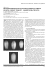 Научная статья на тему 'Автоматизация рентгенографического метода анализа качества семян и товарного зерна злаковых культур'