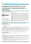 Научная статья на тему 'Cryoglobulinemic vasculitis as a rare complication of rheumatoid arthritis : a case report'