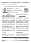 Научная статья на тему 'Диабетическая ретинопатия и секс-стероид-связывающий глобулин: гипотеза или реальная взаимосвязь?'