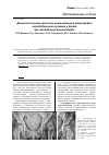 Научная статья на тему 'Диагностическая ценность компьютерной томографии тазобедренного сустава у детей при врожденном вывихе бедра'
