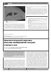 Научная статья на тему 'Диагностический комплекс анализа изображений сосудов глазного дна'