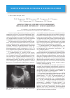 Научная статья на тему 'Диагностика и лечение опухолевидных образований яичников у новорожденных'