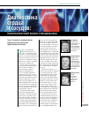 Научная статья на тему 'Диагностика сердца и сосудов: биомеханический анализ гемодинамики'