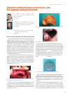 Научная статья на тему 'Дисбаланс микробной флоры в полости рта у лиц, пользующихся зубными протезами'