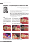 Научная статья на тему 'Эффективная технология при пломбировании молочных зубов'
