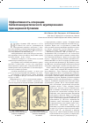 Научная статья на тему 'Эффективность операции билиопанкреатического шунтирования при нервной булимии'