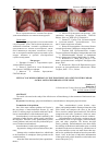 Научная статья на тему 'EFFICACY OF KINESOTHERAPY IN THE TREATMENT OF PATIENTS WITH LUMBARSACRAL OSTEOCHONDROSIS OF THE SPINE'