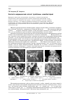 Научная статья на тему 'Эколого-медицинский аспект проблемы нанобактерий'
