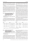 Научная статья на тему 'ЭЛЕКТРОКАРДИОГРАФИЧЕСКИЕ ПРЕДИКТОРЫ РАЗВИТИЯ НЕБЛАГОПРИЯТНЫХ ЖЕЛУДОЧКОВЫХ АРИТМИЙ У ПАЦИЕНТОВ С ИШЕМИЧЕСКОЙ БОЛЕЗНЬЮ СЕРДЦА'