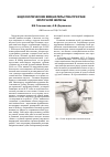 Научная статья на тему 'Эндоскопические вмешательства при раке молочной железы'