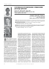 Научная статья на тему 'Эстетическое протезирование с применением диоксида циркония'