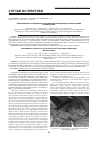 Научная статья на тему 'Флегмонозный аппендицит в грыжевом мешке при рецидивной невправимой паховой грыже'