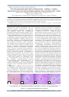 Научная статья на тему 'Гепатозащитное действие комбинации таурина с цинка диаспартатом при тетрахлорметановом гепатозогепатите у крыс'