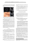 Научная статья на тему 'Гистохимические изменения в зоне раневого дефекта в динамике после применения гидроимпульсной санации и поляризованной светотерапии'