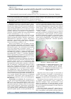 Научная статья на тему 'Гистоструктурный анализ дорсального сагиттального синуса собаки'