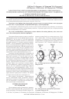 Научная статья на тему 'Характеристика интраоперационных рецидивов атрио-венозного проведения во время катетерной изоляции легочных вен у пациентов с фибрилляцией предсердий'