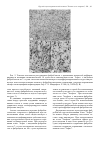Научная статья на тему 'Иммунные нарушения и изменения структурно-функциональных свойств эритроцитов в условиях обострения хронического сальпингоофорита'