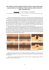 Научная статья на тему 'Investigation of microrelief formation features under multi-pulse nanosecond laser irradiation of metal surface under increased pulse repetition rate'