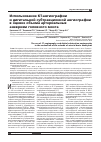 Научная статья на тему 'Использование кт-ангиографиии дигитальной субтракционной ангиографии в оценке объема артериальныханевризм головного мозга'