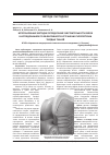 Научная статья на тему 'Использование методик определения чувствительности зубов в исследованиях по эффективности устранения гиперестезии твердых тканей'