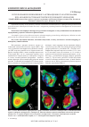 Научная статья на тему 'Использование неинвазивного активационного картирования при аблации постинфарктной желудочковой тахикардии'