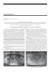 Научная статья на тему 'Использование прижизненных ортопантомограмм в целях идентификации личности'