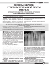 Научная статья на тему 'Использование стекловолоконной ленты Interlig для шинирования зубов при лечении заболеваний пародонта'