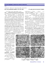 Научная статья на тему 'Исследование микроструктуры 9-12% Cr стали для роторов турбин'