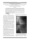 Научная статья на тему 'Исследование текстурных признаков для диагностики заболеваний костной ткани по рентгеновским изображениям'