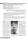 Научная статья на тему 'Изменения слизистой оболочки верхнечелюстных пазух при одонтогенных синуситах'