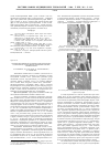 Научная статья на тему 'Изучение возможности магнитно-резонансной томографии при обследовании неизмененных больших слюнных желез'