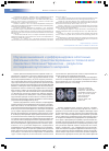Научная статья на тему 'Изучение выживания и дифференцировки аллогенных фетальных клеток, трансплантированных в головной мозг пациентам с болезнью Паркинсона результаты исследования аутопсийного материала'