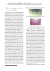 Научная статья на тему 'К вопросу о пластике брюшной аорты аутотканью'