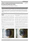 Научная статья на тему 'К вопросу о влиянии лазерной дисцизии вторичной катаракты на состояние макулярной зоны сетчатки'